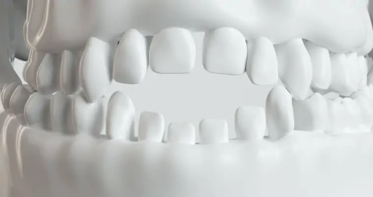 Consecuencias del uso prolongado del chupete - Adeslas Dental