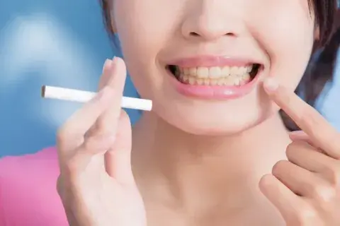 Dientes de fumador