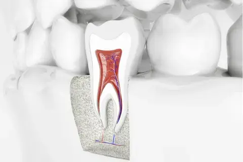 nervio dental