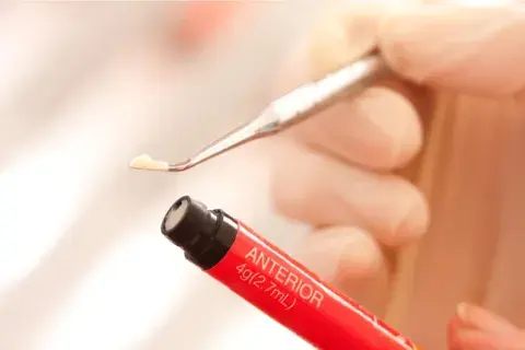 resina dental