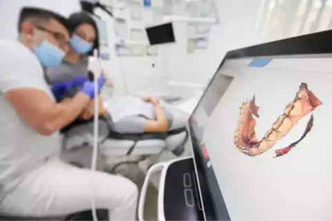 Escáner intraoral