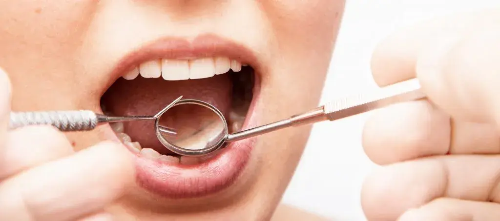 ¿Qué es la periodontitis?