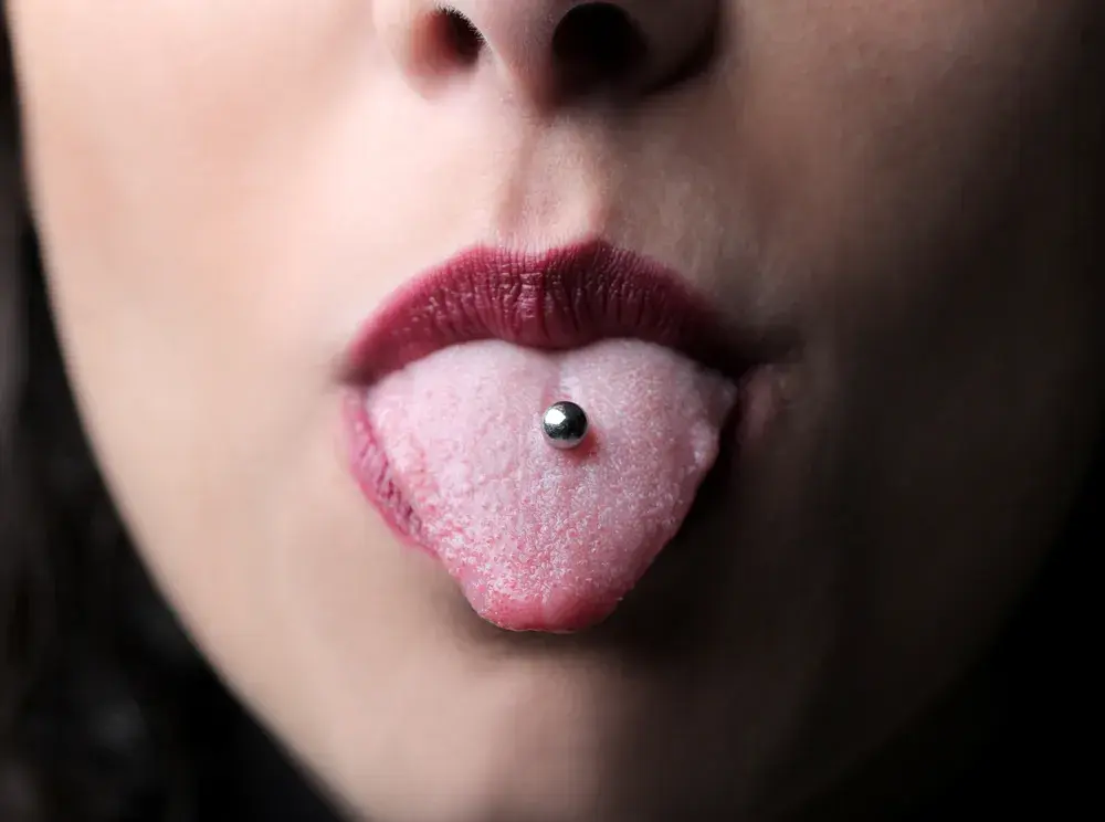 Piercing y braquets: una combinación arriesgada