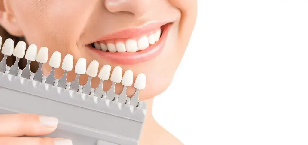 ¿Cuál es el color natural de los dientes?