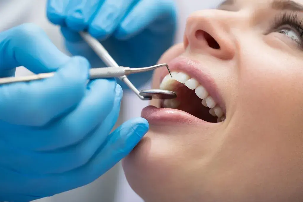 Tipos de caries