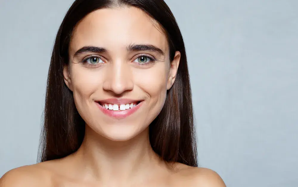 Diastema dental o la moda de las paletas separadas: Qué es, qué efectos tiene y cómo corregirlo