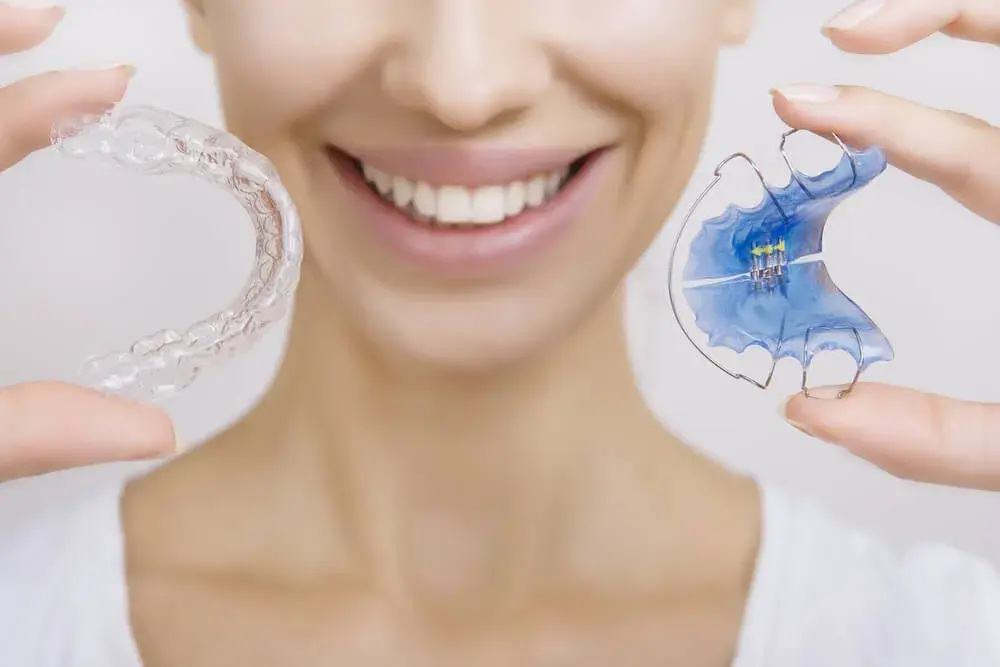 Tipos de retenedores para dientes