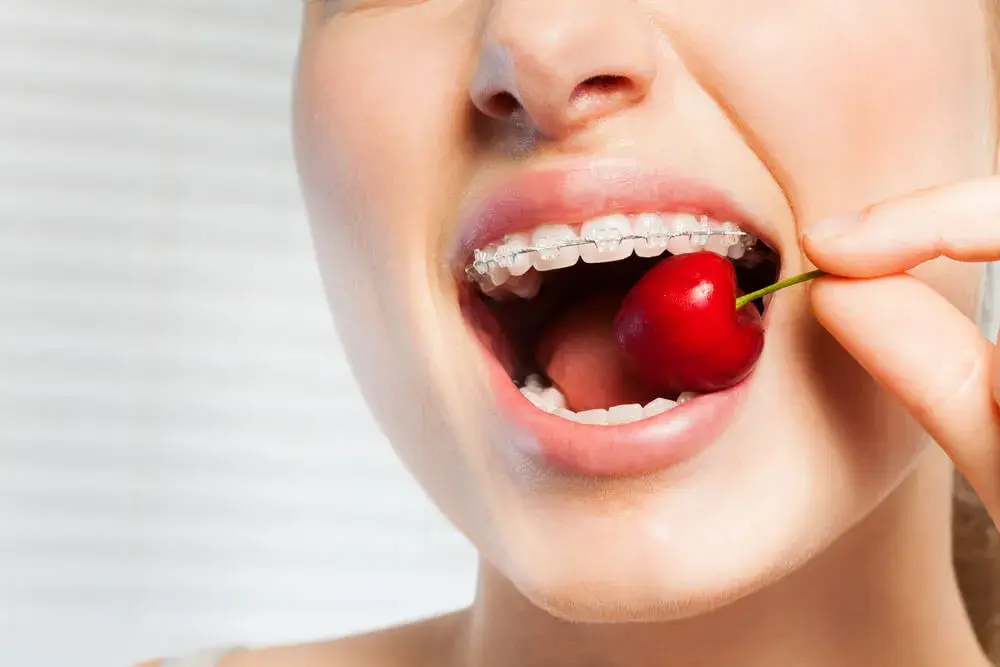 Alimentos prohibidos cuando llevas brackets