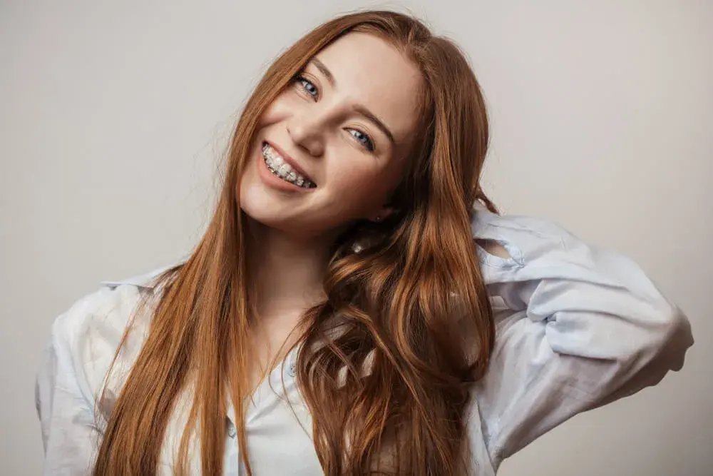 5 consejos para besar con brackets