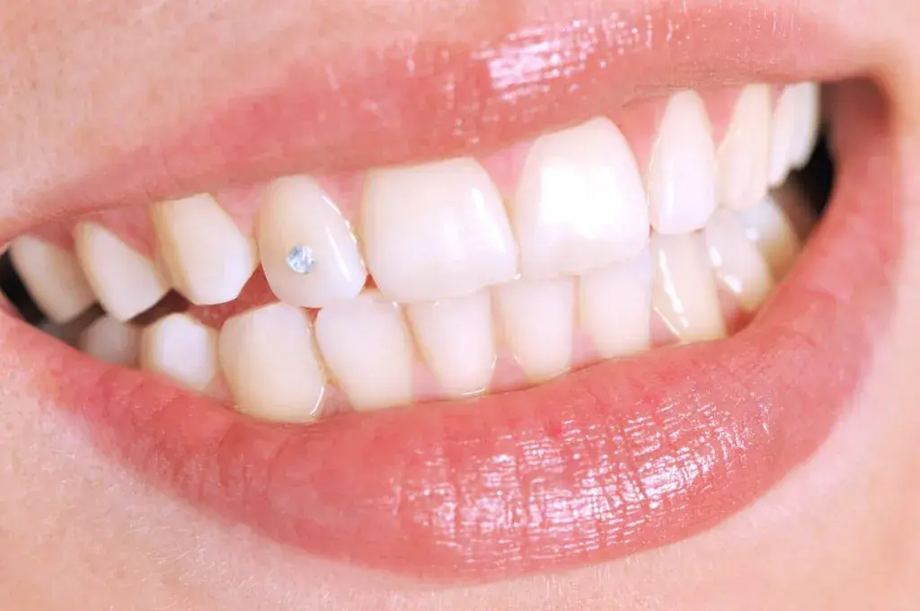 La moda de ponerse brillantes en los dientes