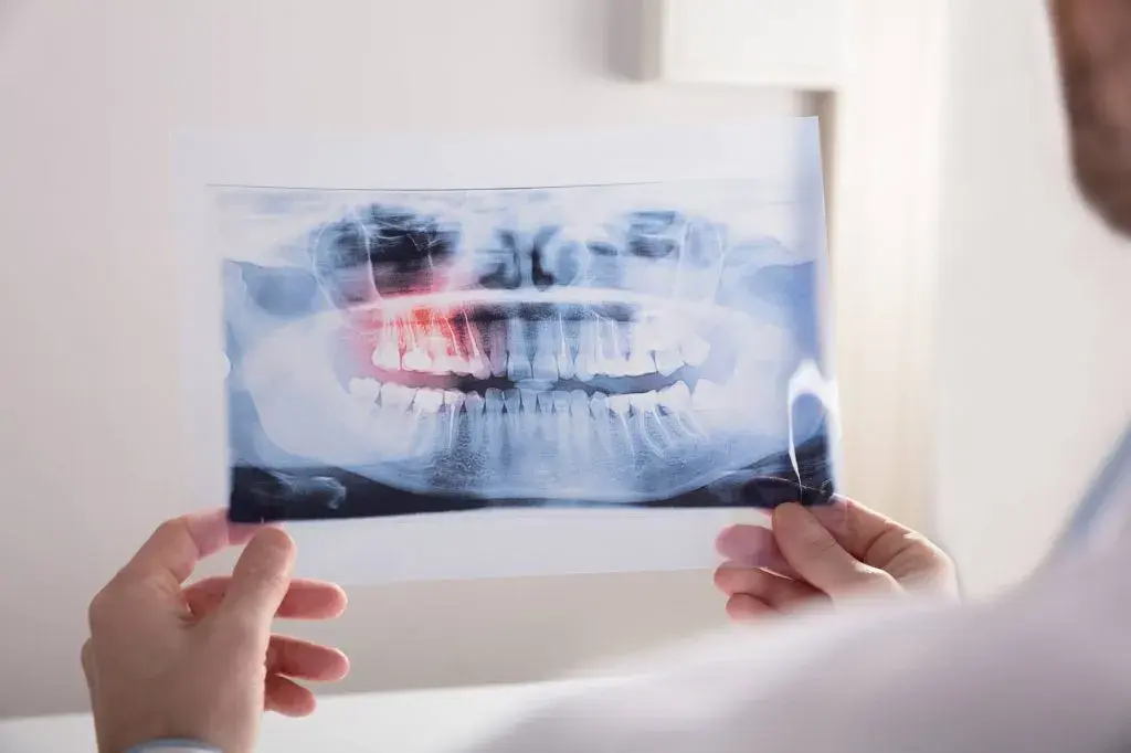 Qué es un TAC Dental y cómo se hace