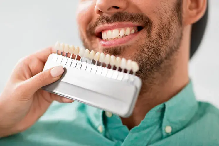 Escala de color de los dientes: cuántos blancos hay