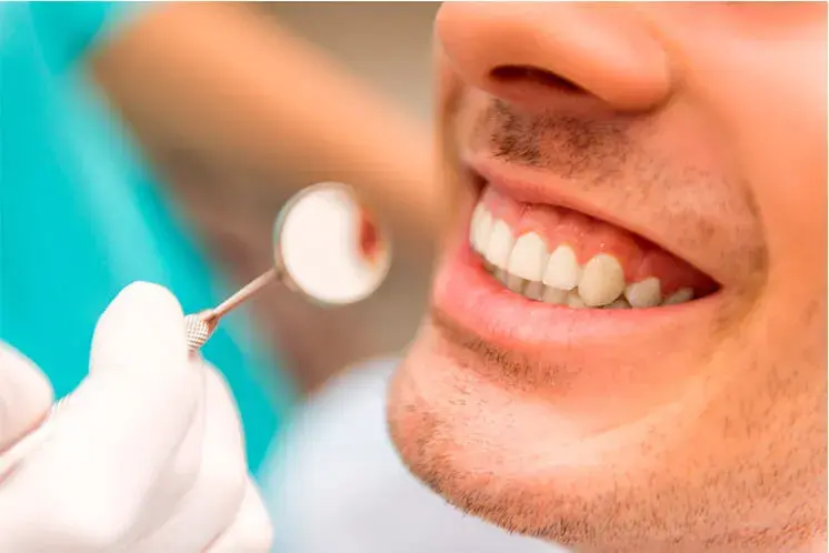 ¿Qué es la hipoplasia dental o hipoplasia de esmalte?