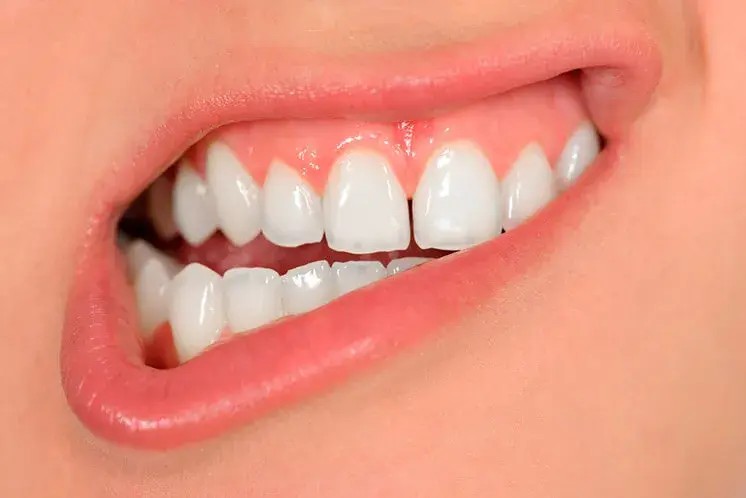 Qué hacer si tengo un agujero en los dientes