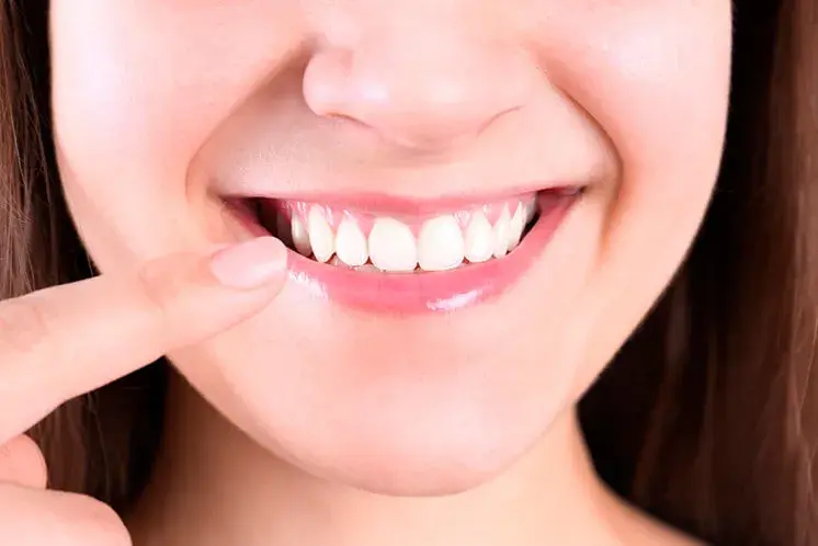¿Qué es la línea mucogingival?