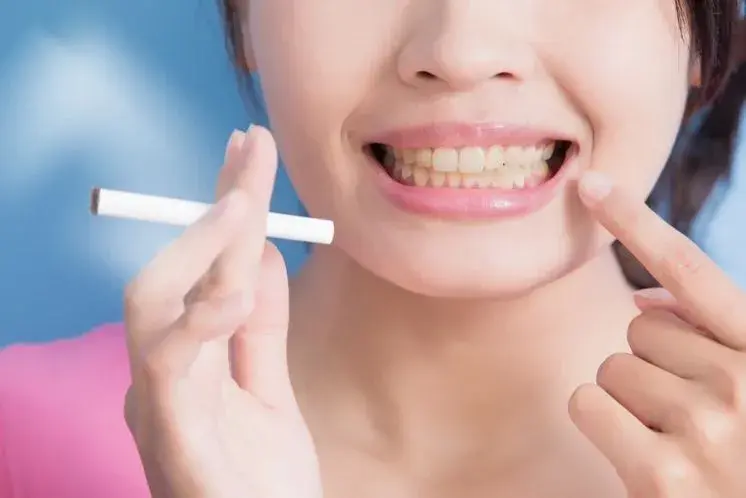 Dientes de fumador: enfermedades y efectos del tabaco