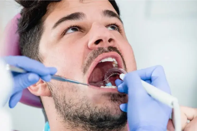 Diferencias entre raspado y limpieza dental