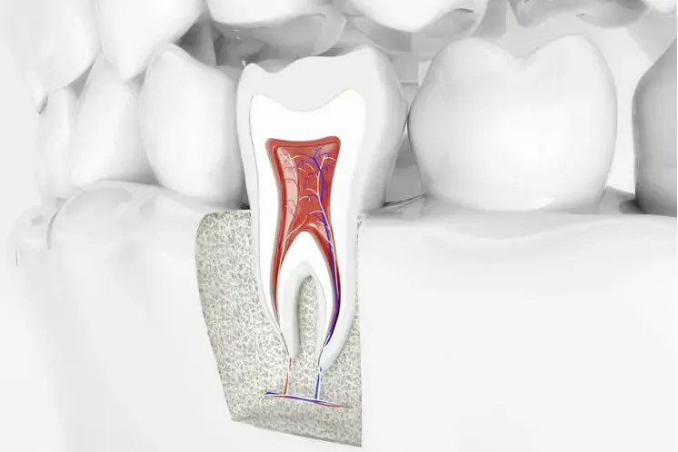 Nervio dental y dolor de muelas