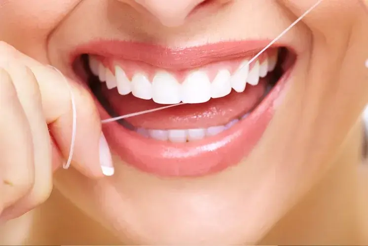 Caries interproximales: características, diagnóstico y tratamiento