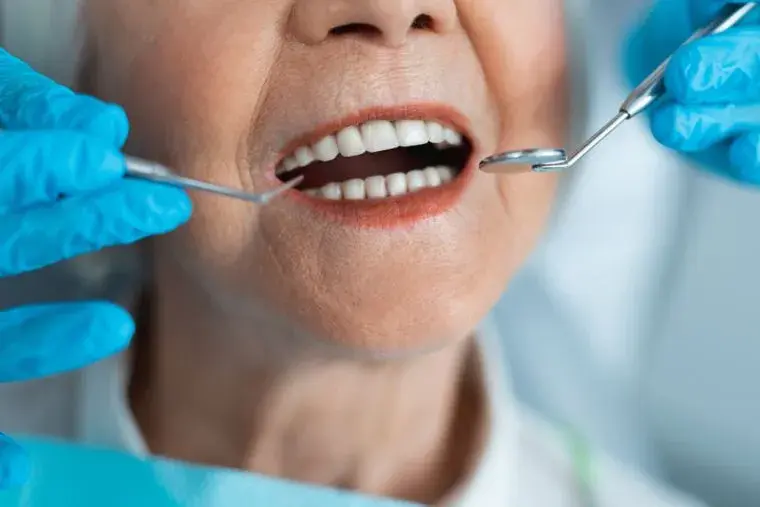 Bifosfonatos y odontología: extracciones, efectos secundarios y usos