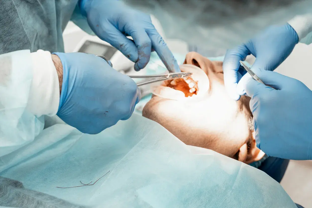 Nuevas tecnologías en implantología dental: Cirugía guiada y carga inmediata