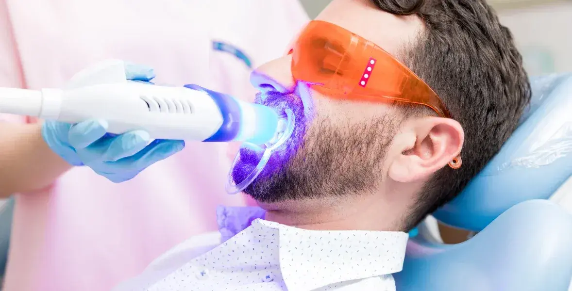Blanqueamiento en dientes no vitales