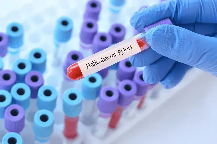 Helicobacter pylori y su impacto en la salud dental