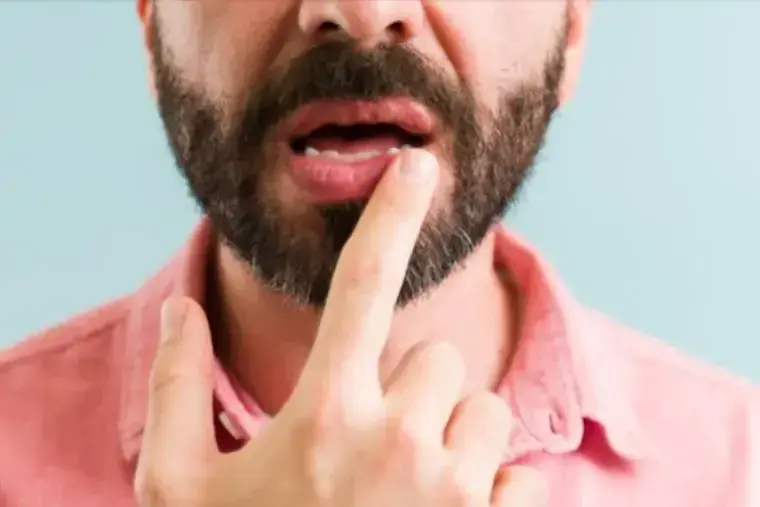 ¿Qué es el mucocele y por qué aparece?