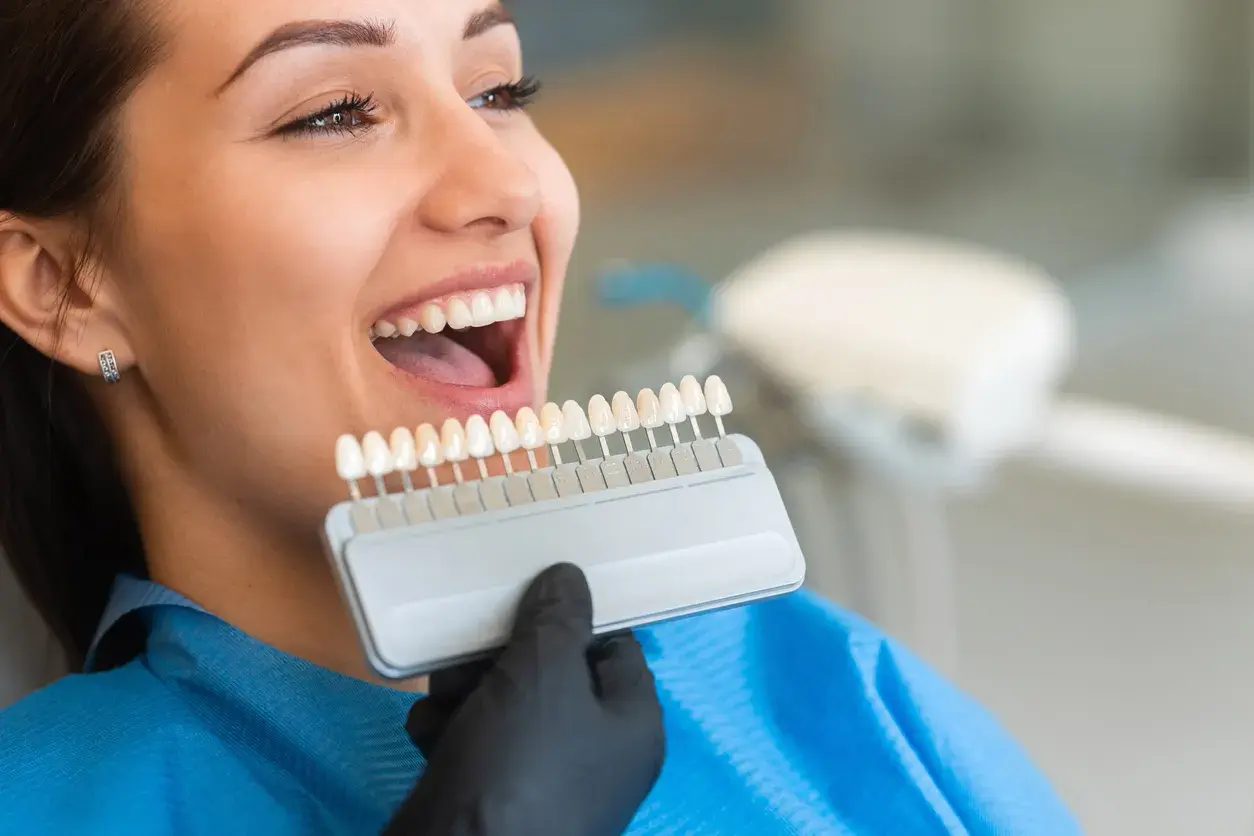 Mejorar la sonrisa: Carillas dentales
