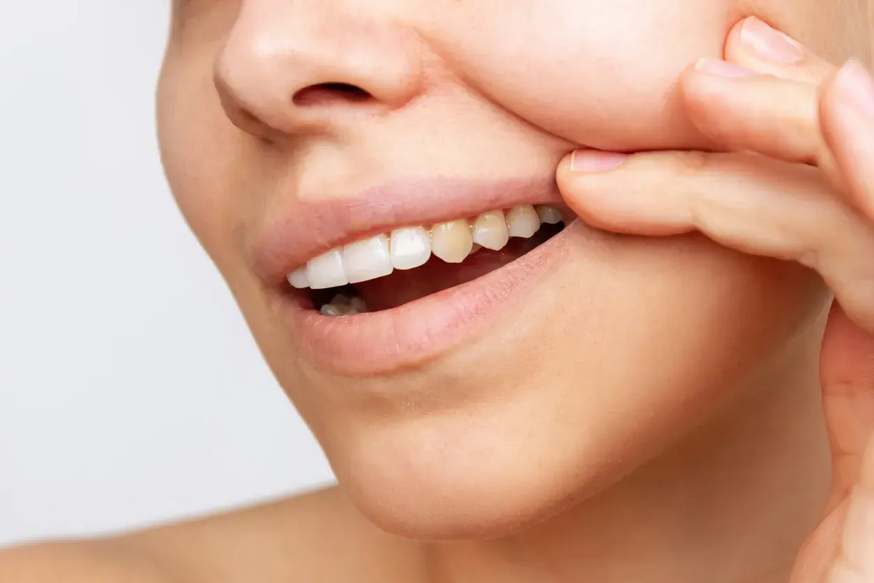 Se me han oscurecido los dientes, ¿a qué se debe?