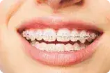 Brackets zafiro