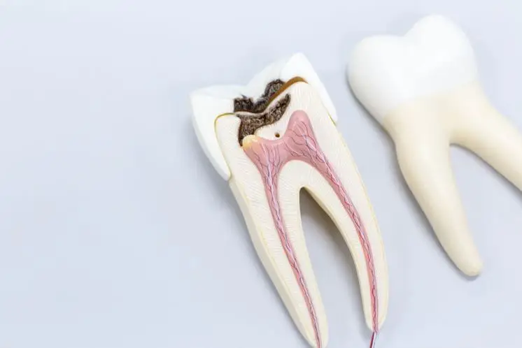 La raíz del diente