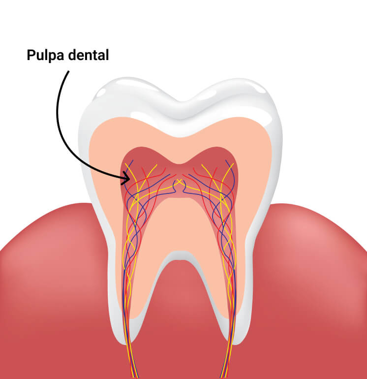 Pulpa dental que contiene los vasos sanguíneos y los nervios del diente