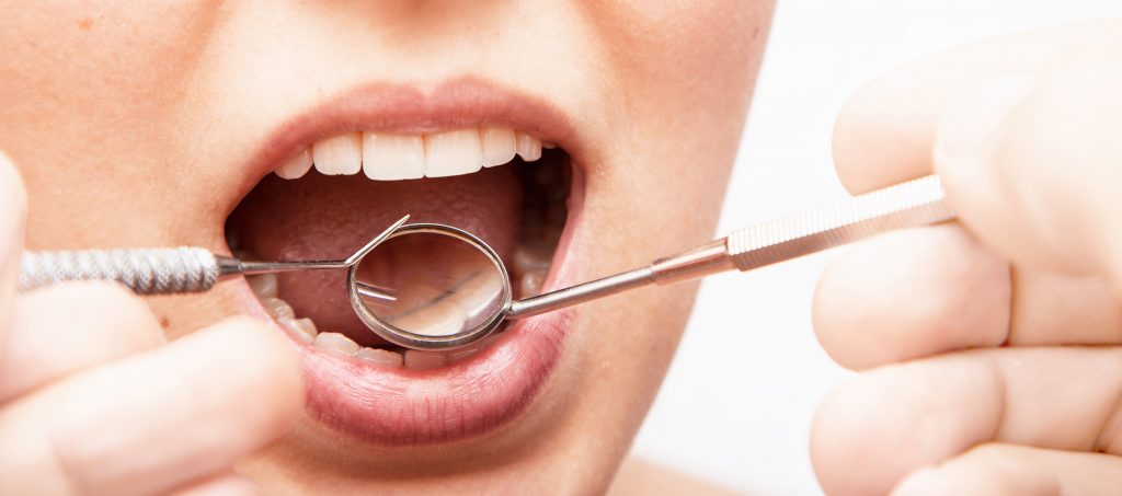 boca periodontitis