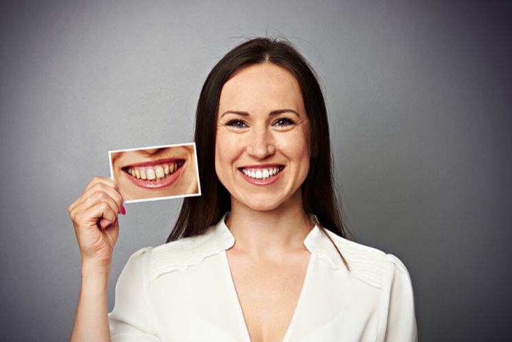 Dona sosté una fotografia d'un somriure amb amelogénesis imperfecta