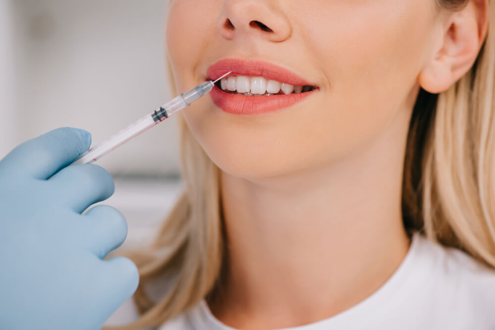 anestesias dentales: boca inyección